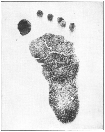 THE BABY’S FOOTPRINT

A means of positive identification