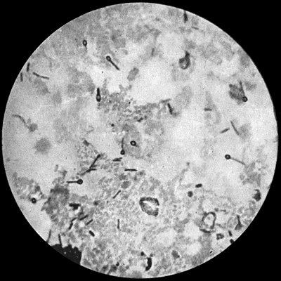 Fig. 26.—Bacillus of Tetanus from scraping of a wound of finger, × 1000 diam. Basic fuchsin stain.