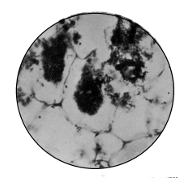 Nitrogen Fixing Bacteria