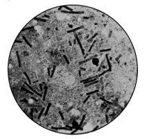 Bacillus Anthracis