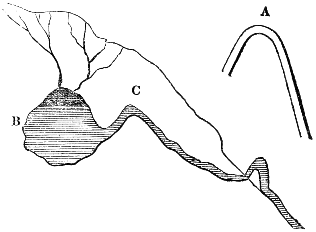 A: bent tube; B: water-filled cavity; C: channel out of cavity