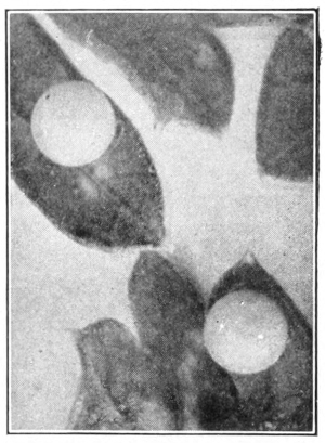 Butterfly eggs